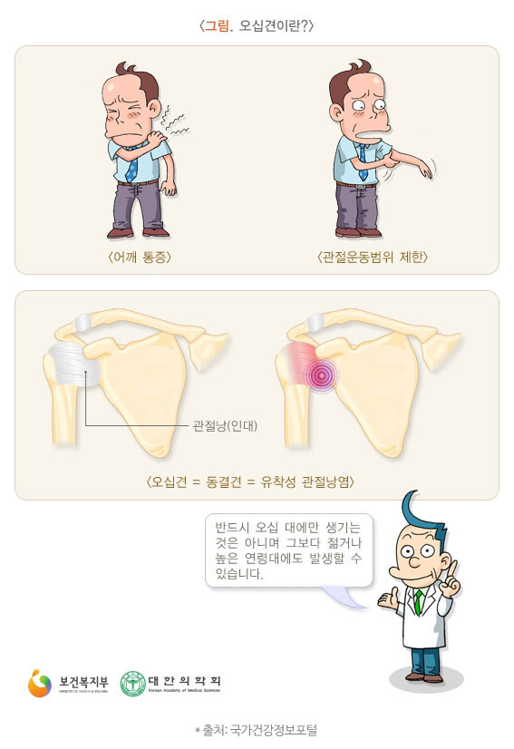 오십견